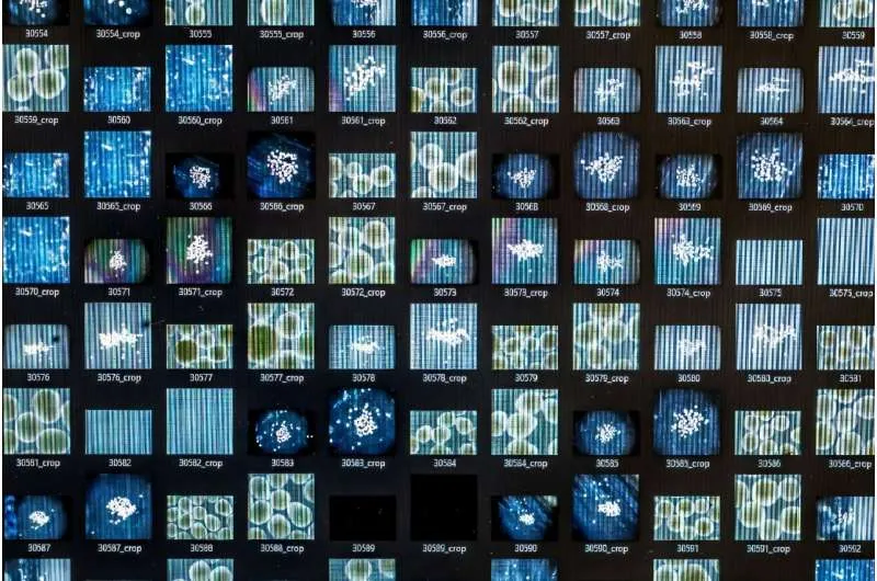 Сотрудник FinalSpark Флора Броцци обеспечивает клетки мозга необходимой для выживания жидкостью